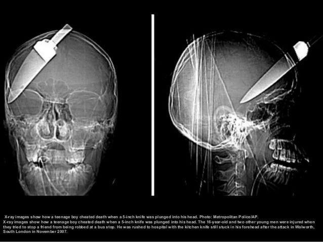 Craziest X,rays